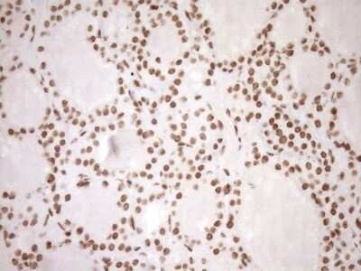 Immunohistochemistry: Exosome component 1 Antibody (OTI1H9) - Azide and BSA Free [NBP2-71895]