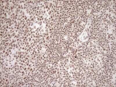 Immunohistochemistry: Exosome component 1 Antibody (OTI1H9) - Azide and BSA Free [NBP2-71895]