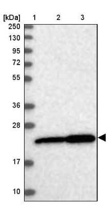 Western Blot: Exosome component 1 Antibody [NBP1-84523]