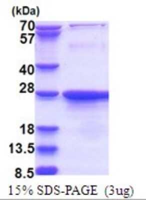 SDS-PAGE: Recombinant Human Exosome component 1 His Protein [NBP2-51735]