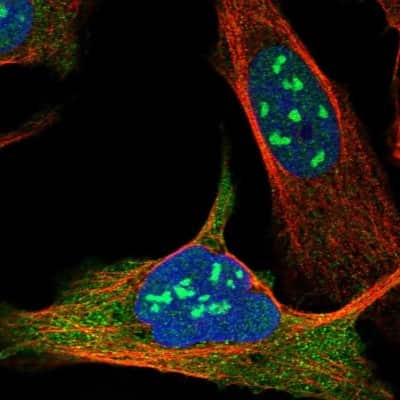 Immunocytochemistry/ Immunofluorescence: Exosome component 10 Antibody [NBP1-82447]