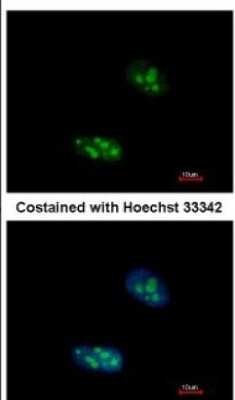 Immunocytochemistry/ Immunofluorescence: Exosome component 10 Antibody [NBP2-16393]
