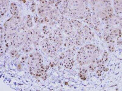 Immunohistochemistry-Paraffin: Exosome component 10 Antibody [NBP1-32870]