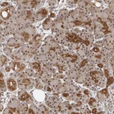 Immunohistochemistry-Paraffin: Exosome component 10 Antibody [NBP1-82447]