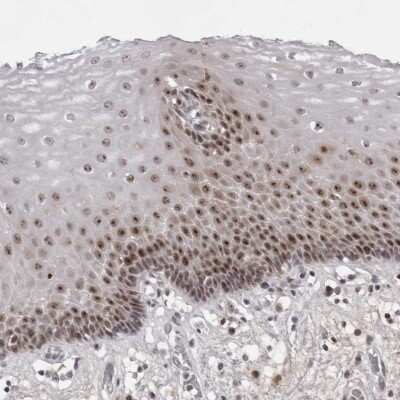 Immunohistochemistry-Paraffin: Exosome component 10 Antibody [NBP1-82448]