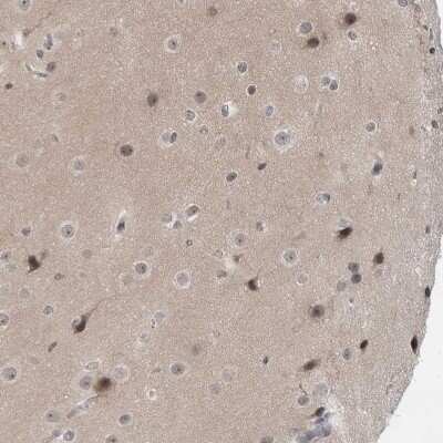 Immunohistochemistry-Paraffin: Exosome component 10 Antibody [NBP1-82448]