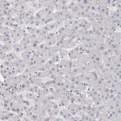 Immunohistochemistry-Paraffin: Exosome component 10 Antibody [NBP1-82448]