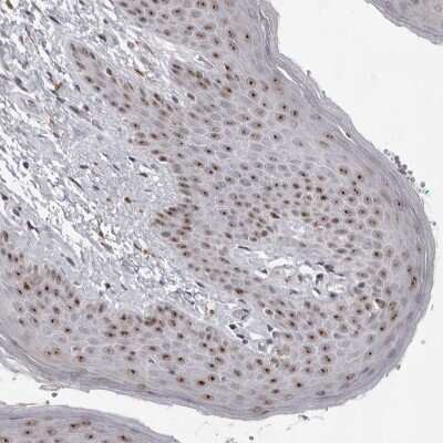 Immunohistochemistry-Paraffin: Exosome component 10 Antibody [NBP1-82448]