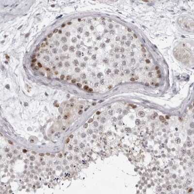 Immunohistochemistry-Paraffin: Exosome component 10 Antibody [NBP1-82448]