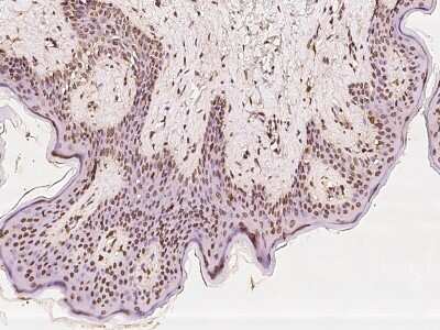 Immunohistochemistry-Paraffin: Exosome component 10 Antibody [NBP2-97516]