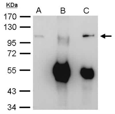 Western Blot: Exosome component 10 Antibody [NBP1-32870]