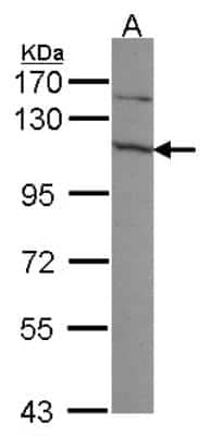 Western Blot: Exosome component 10 Antibody [NBP1-32870]