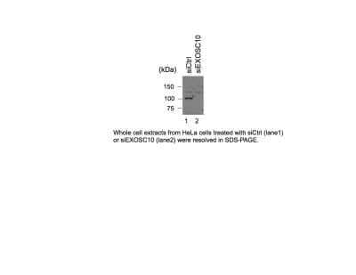 Western Blot: Exosome component 10 Antibody [NBP1-32870]