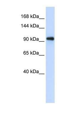 Western Blot: Exosome component 10 Antibody [NBP1-57184]