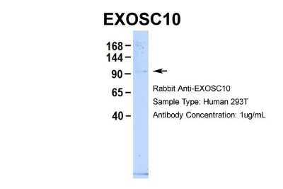 Western Blot: Exosome component 10 Antibody [NBP1-57184]