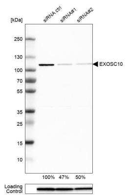 Western Blot: Exosome component 10 Antibody [NBP1-82448]