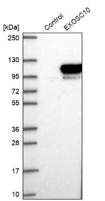 Western Blot: Exosome component 10 Antibody [NBP1-82448]