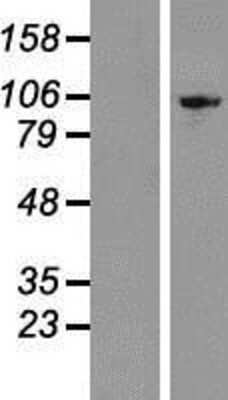 Western Blot: Exosome component 10 Overexpression Lysate [NBP2-10723]