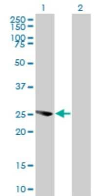 Western Blot: Exosome component 4 Antibody (4F10) [H00054512-M01]