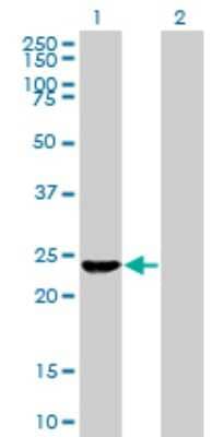 Western Blot: Exosome component 4 Antibody (4F9) [H00054512-M02]