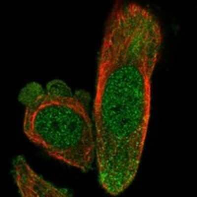 Immunocytochemistry/ Immunofluorescence: Exosome component 4 Antibody [NBP3-17711]