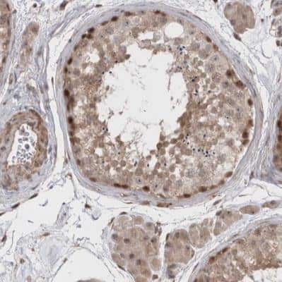Immunohistochemistry-Paraffin: Exosome component 4 Antibody [NBP1-82170]