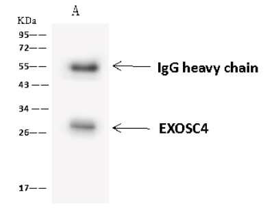 Immunoprecipitation: Exosome component 4 Antibody [NBP2-97799]