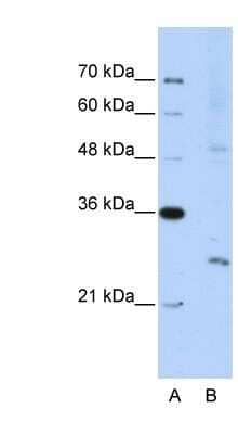 Western Blot: Exosome component 4 Antibody [NBP1-57180]