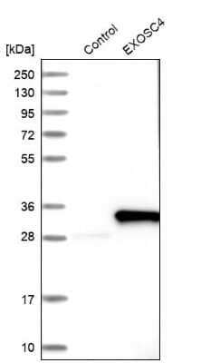 Western Blot: Exosome component 4 Antibody [NBP1-82170]