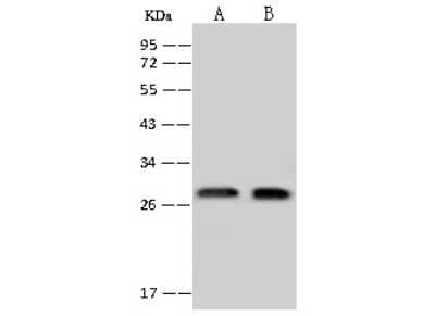 Western Blot: Exosome component 4 Antibody [NBP2-97799]