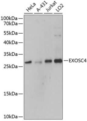 Western Blot: Exosome component 4 AntibodyAzide and BSA Free [NBP3-03385]