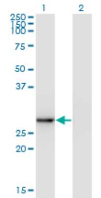 Western Blot: Exosome component 5 Antibody (1E11) [H00056915-M05]