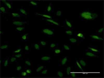 Immunocytochemistry/ Immunofluorescence: Exosome component 5 Antibody (2E7) [H00056915-M03]