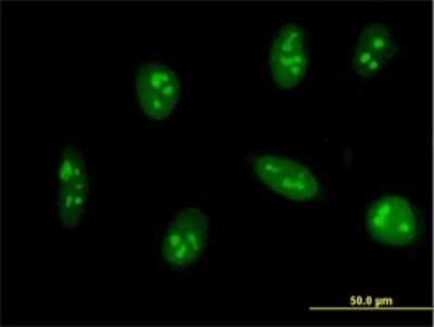 Immunocytochemistry/ Immunofluorescence: Exosome component 5 Antibody (6G11) [H00056915-M01]