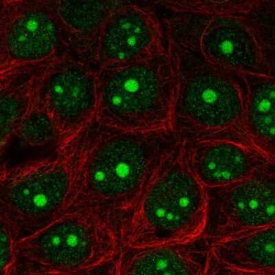 Immunocytochemistry/ Immunofluorescence: Exosome component 5 Antibody [NBP2-56887]