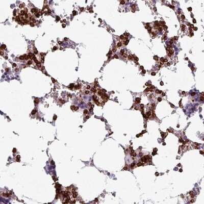 Immunohistochemistry: Exosome component 5 Antibody [NBP2-33677]