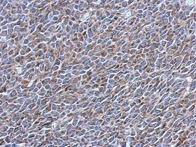Immunohistochemistry-Paraffin: Exosome component 5 Antibody [NBP2-14952]