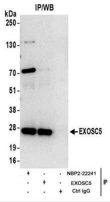 Immunoprecipitation: Exosome component 5 Antibody [NBP2-22241]