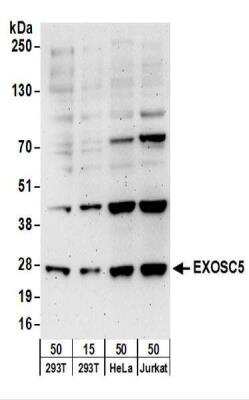 Western Blot: Exosome component 5 Antibody [NBP2-22241]