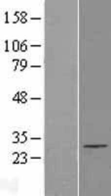 Western Blot: Exosome component 5 Overexpression Lysate [NBL1-10387]