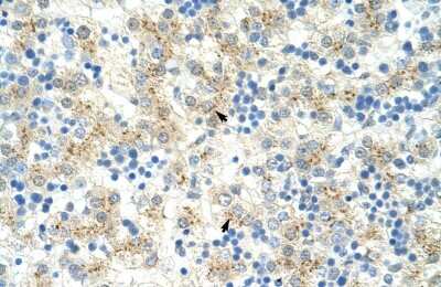 Immunohistochemistry-Paraffin: Exosome component 6 Antibody [NBP1-57508]