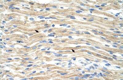 Immunohistochemistry-Paraffin: Exosome component 6 Antibody [NBP1-57508]