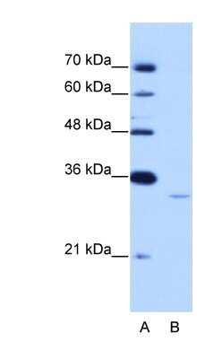 Western Blot: Exosome component 6 Antibody [NBP1-57471]