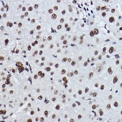Immunohistochemistry-Paraffin: Exosome component 7 Antibody (0B8G6) [NBP3-15259]