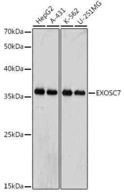 Western Blot: Exosome component 7 Antibody (0B8G6) [NBP3-15259]