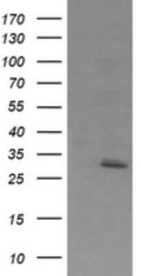 Western Blot: Exosome component 7 Antibody (OTI1E8) [NBP2-45546]