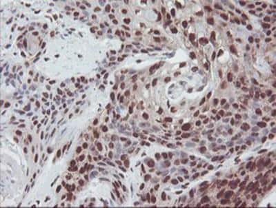 Immunohistochemistry-Paraffin: Exosome component 7 Antibody (OTI1G8) [NBP2-01732]