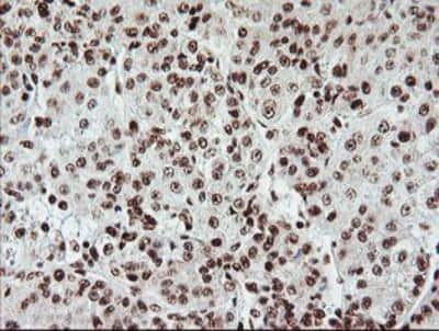 Immunohistochemistry-Paraffin: Exosome component 7 Antibody (OTI1G8) [NBP2-01732]