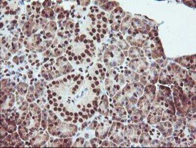 Immunohistochemistry-Paraffin: Exosome component 7 Antibody (OTI1G8) [NBP2-01732]
