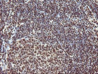 Immunohistochemistry-Paraffin: Exosome component 7 Antibody (OTI1G8) [NBP2-01732]